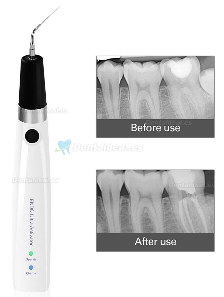 Cordless Ultrasonic Dental Endo Ultra Activator Handpiece 300° Irrigator Pen CE